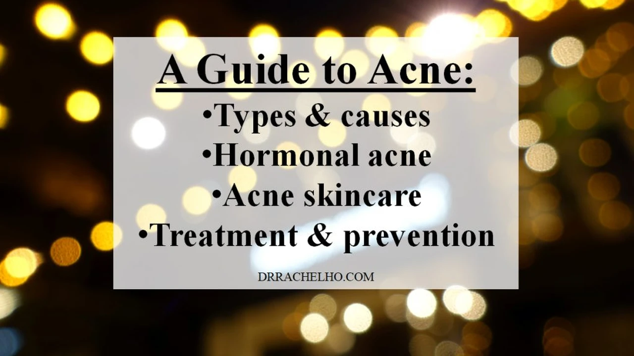 Easy Chorizo Street Tacos